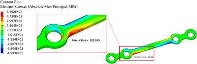 Experimental analysis and numerical fatigue life prediction of 3D-Printed osteosynthesis plates